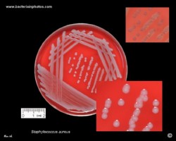 colonies of staph without yellow pigmentation